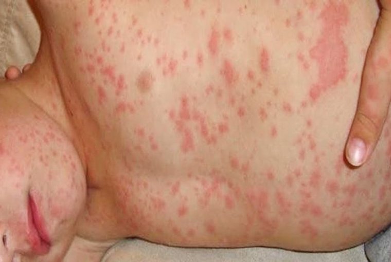 Tragédia utáni „csend”