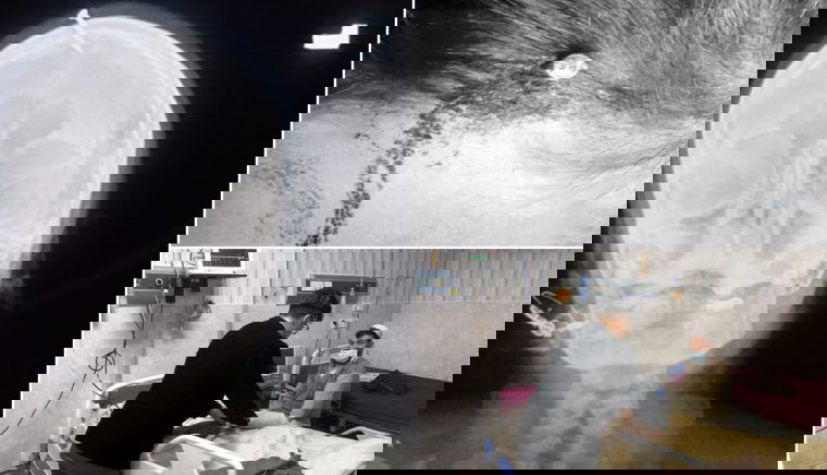 Szöget vert egy terhes nő fejébe egy kuruzsló, hogy fia szülessen