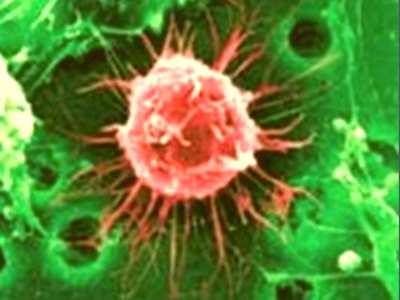 •  Fotó: Ilusztráció