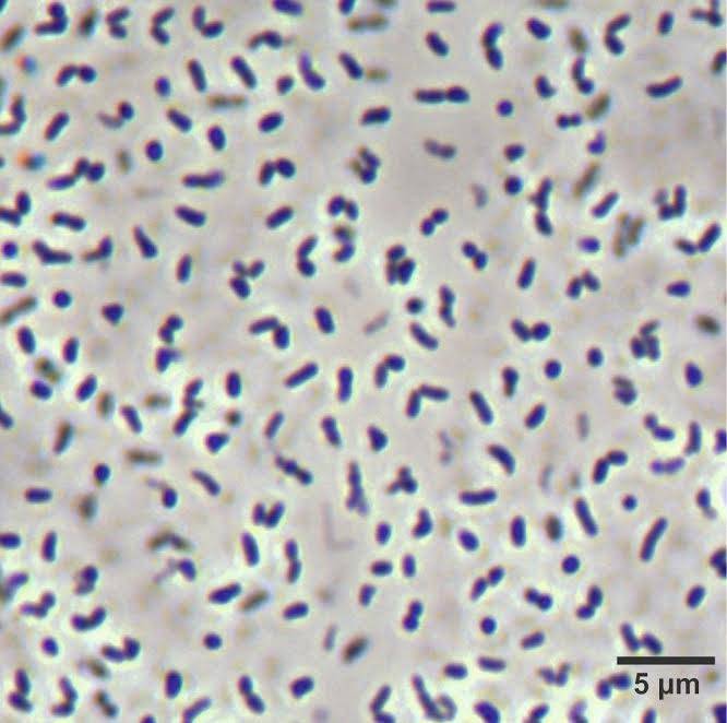 A Caenimicrobium hargitense mikroszkóp alatt •  Fotó: Sapientia