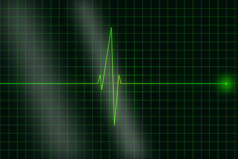 Az elvégezhető vizsgálatok között az egyik legfontosabb a terheléses EKG (elektrokardiogramm) •  Fotó: Pixabay.com