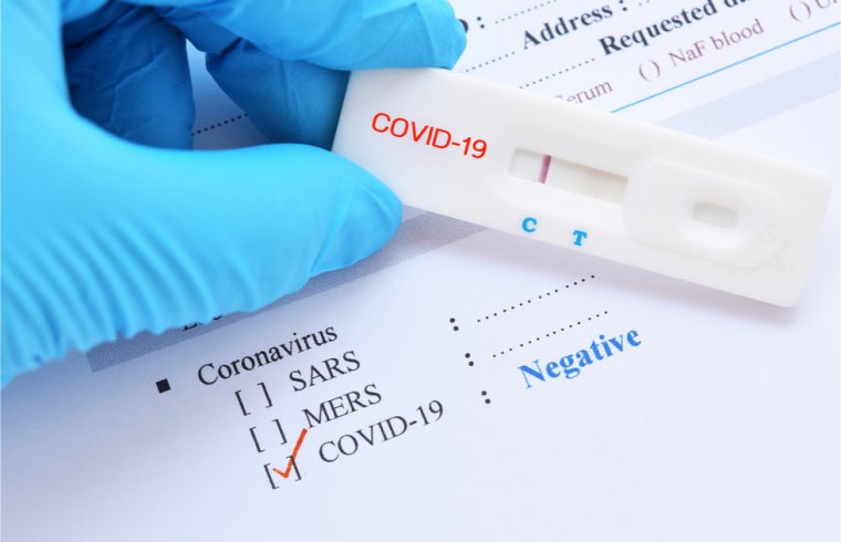 Hamis negatív PCR-teszteket áruló személyszállító cégekre csapott le a rendőrség