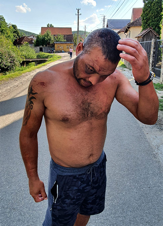 A verés nyomait mutatja a sértett fél •  Fotó: Mezei Tímea