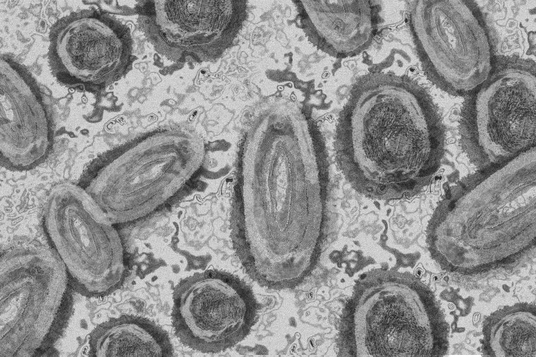 Megjelent Európában is a majomhimlő új vírusváltozata, amely Afrikában súlyos járványkitörést okozott