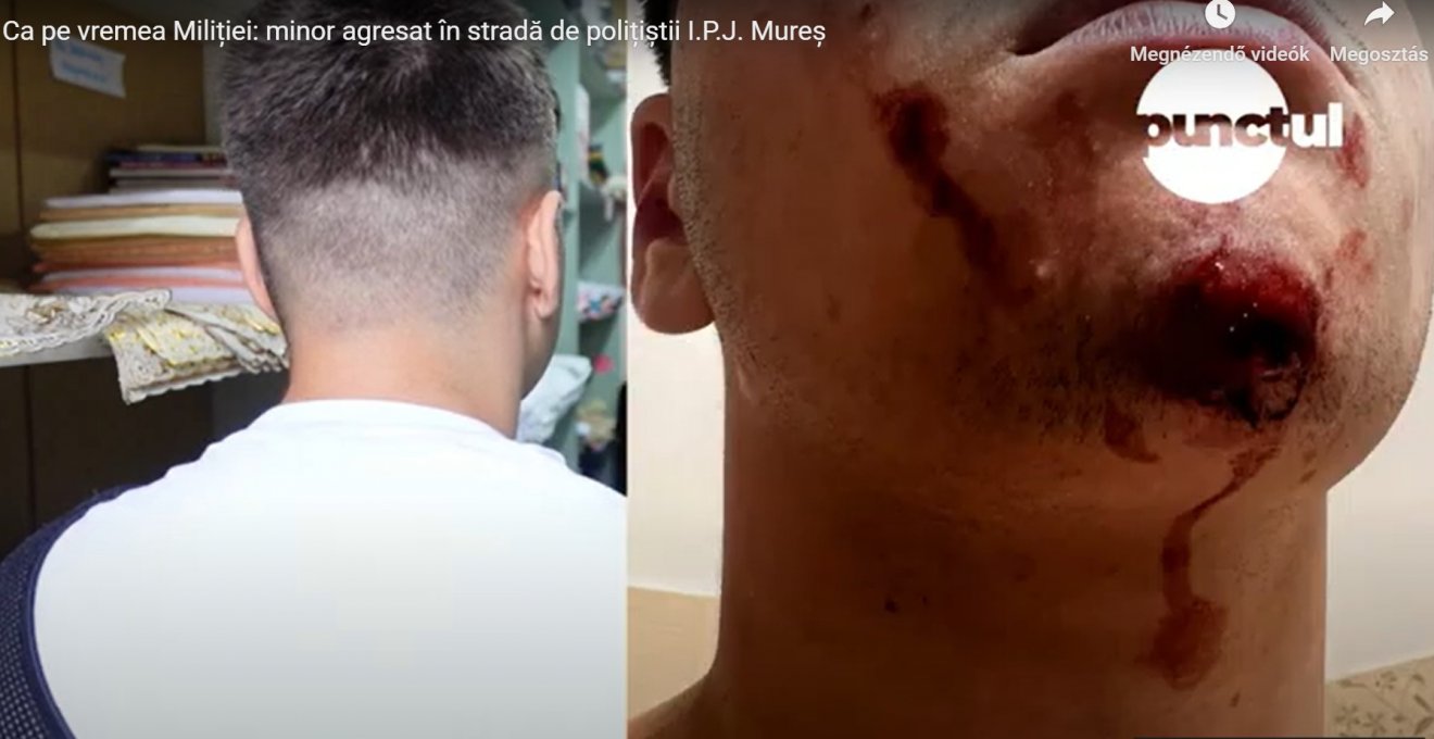 A rendőröket bántalmazással vádoló fiatal felkötött karral nyilatkozik (balra, háttal), a jobboldali felvételen pedig az arcán elszenvedett sérülések láthatóak •  Fotó: Videófelvétel/Punctul.ro