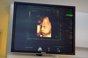 A vajúdás és a szülés ideje alatt végig a kismamák mellett lehet egy általuk választott személy