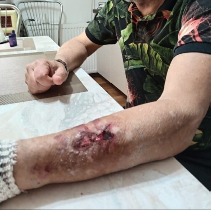 Megszólalt a Krónikának a „lebozgorozott” szászfenesi férfi, kivizsgálja a magyarellenes támadást a rendőrség