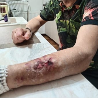 Megszólalt a Krónikának a „lebozgorozott” szászfenesi férfi, kivizsgálja a magyarellenes támadást a rendőrség