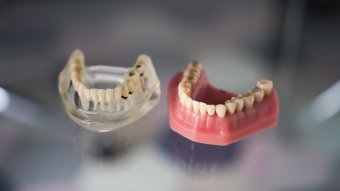 Sokan kénytelenek nélkülözni a fogorvosi ellátást Romániában