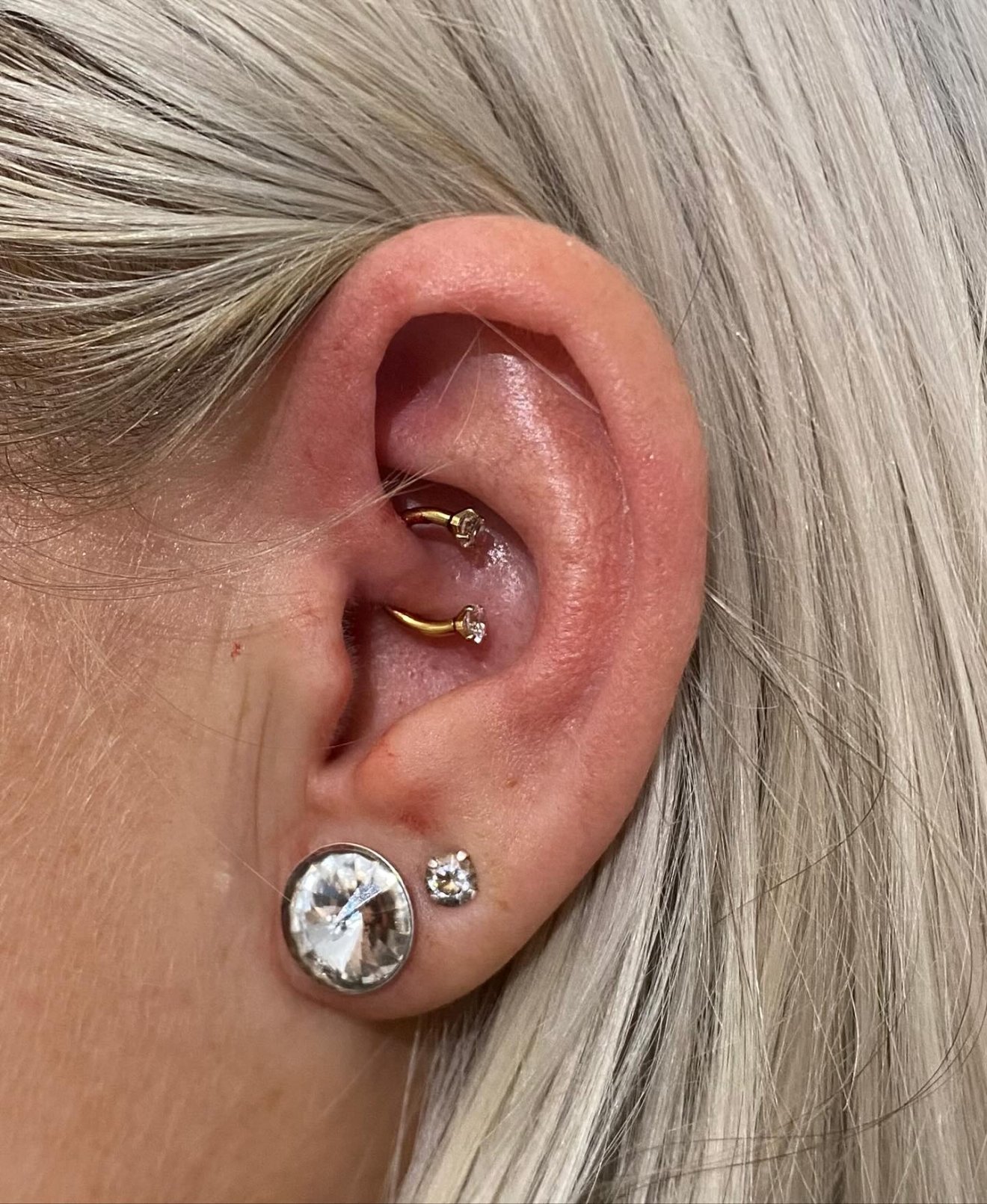 gyógypiercing