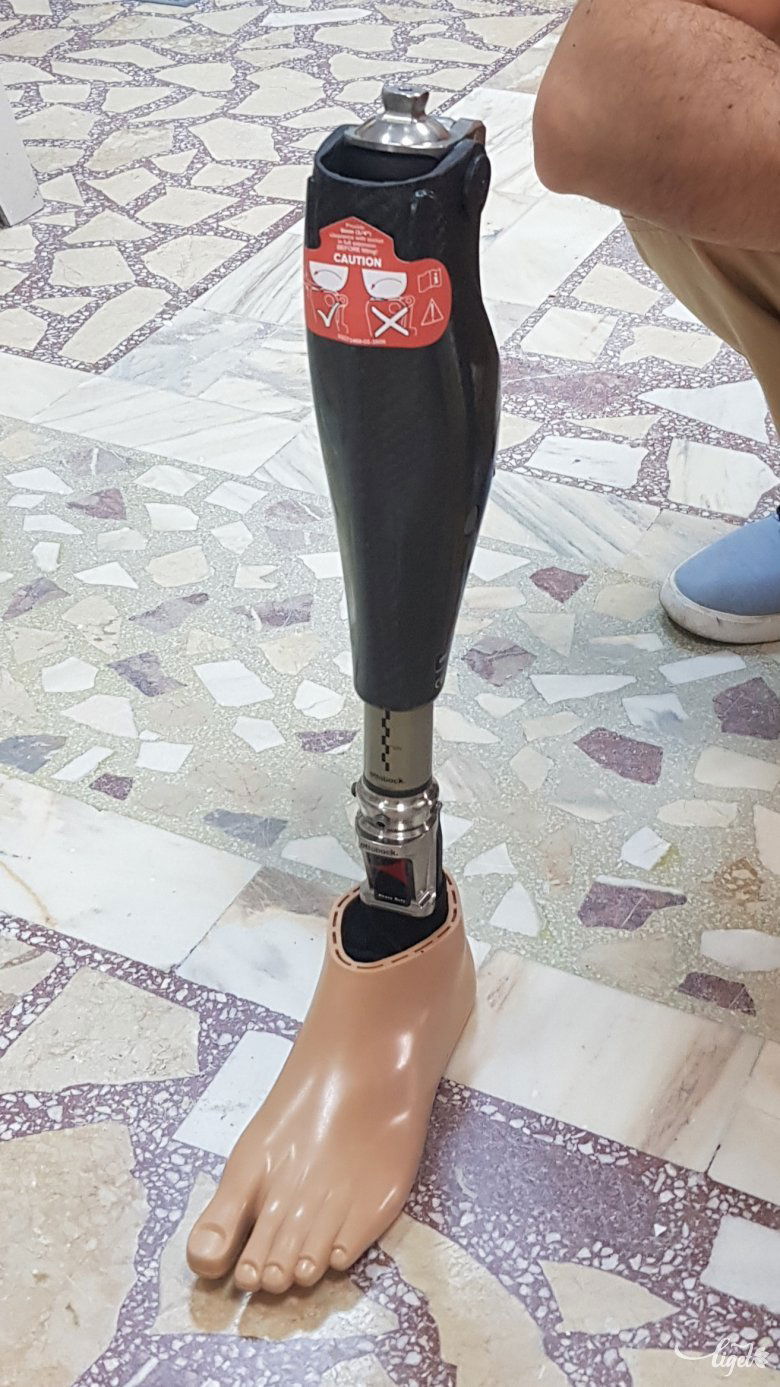Így néz ki összeszerelve a Genium X3 elnevezésű protézis 