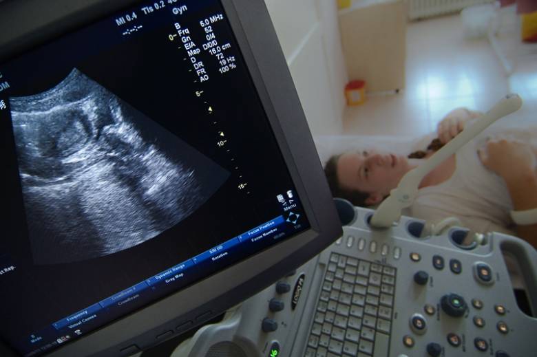 A nőgyógyászok véleménye is megoszlik a terhesség alatti szoptatásról 