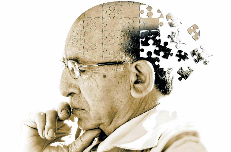 Alzheimer, az öregkori elbutulás