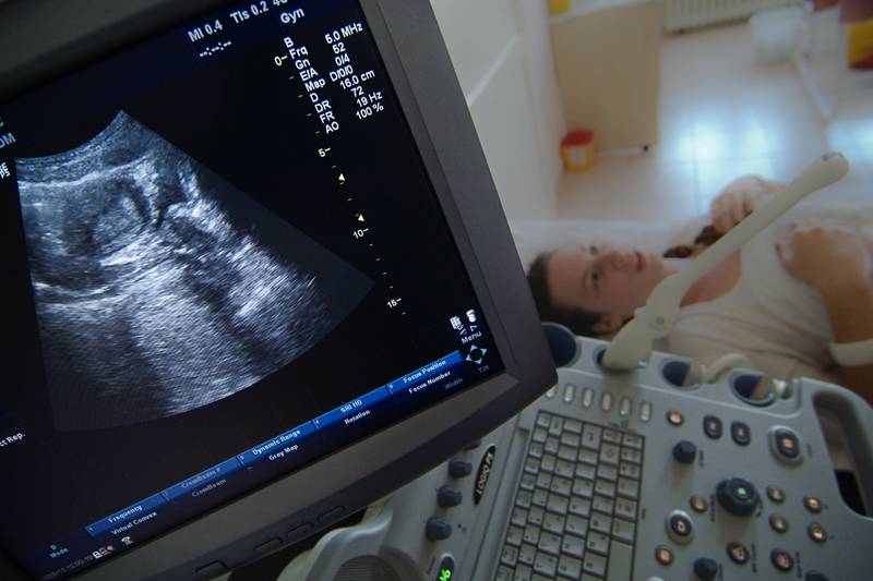 A nőgyógyászok véleménye is megoszlik a terhesség alatti szoptatásról 