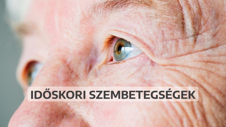 Szemünk fénye: időskori szembetegségek
