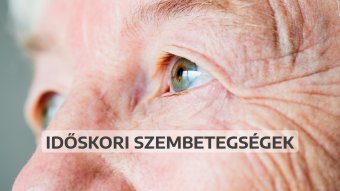 Szemünk fénye: időskori szembetegségek