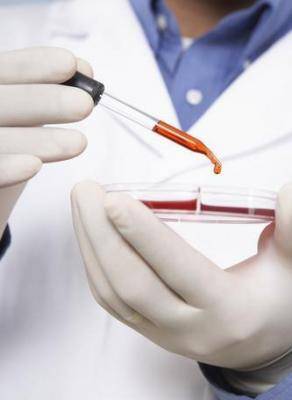 Ingyenes hepatitiszvizsgálat Marosvásárhelyen