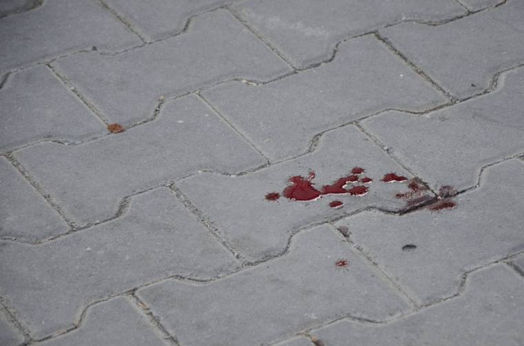 Elütöttek egy gyalogost Székelyudvarhelyen