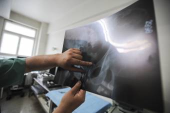 A férfiak egyik leggyakrabban diagnosztizált daganatos betegsége – sokat számít a korai felismerés