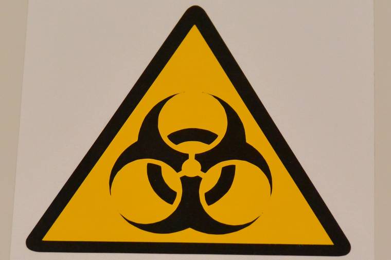 Nem működik a vásárhelyi kórház röntgengépe, körülményes az alternatíva