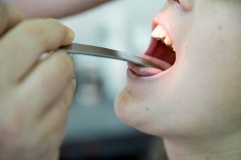 Hét skarlátgyanús esetet jelentettek egy marosvásárhelyi iskolából