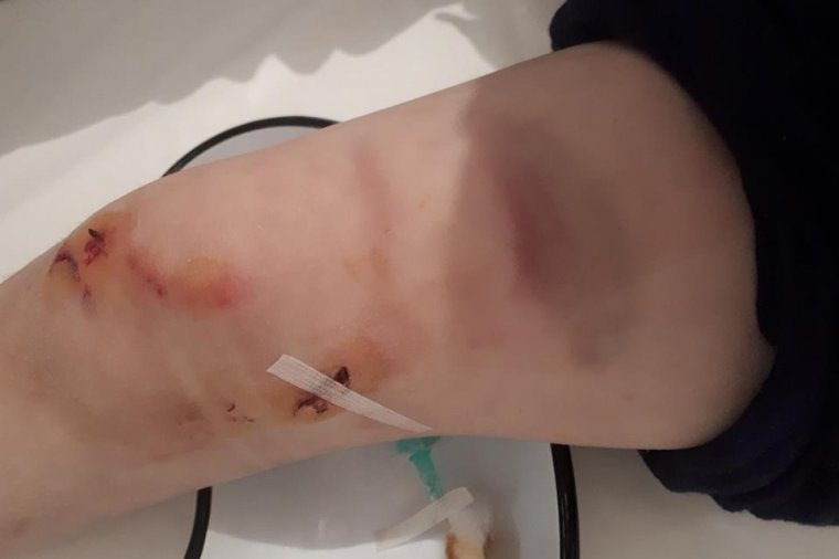 Emberre támadt a medve Szovátán, egy esztena közelében