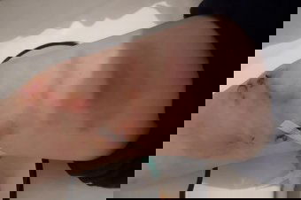 Emberre támadt a medve Szovátán, egy esztena közelében