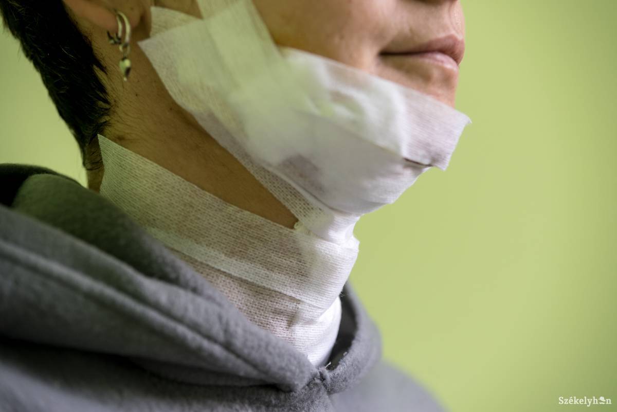 A férfi által ejtett késszúrásokat kezdetben testi sértésnek minősítették. Utólag súlyosbították ezt •  Fotó: Veres Nándor