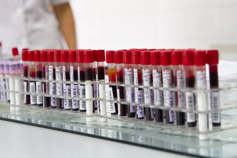 A kislányok állapota stabil, de hátravan még egy kemoterápia