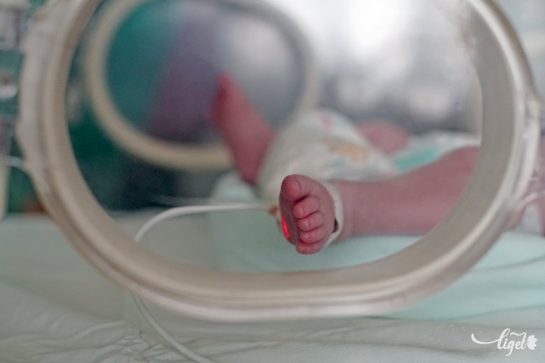 A korababák nagy harcosok, akik siettek erre a világra. Képünk illusztráció •  Fotó: Haáz Vince
