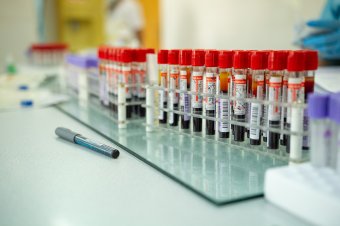 Vérszegény időszak a nyár