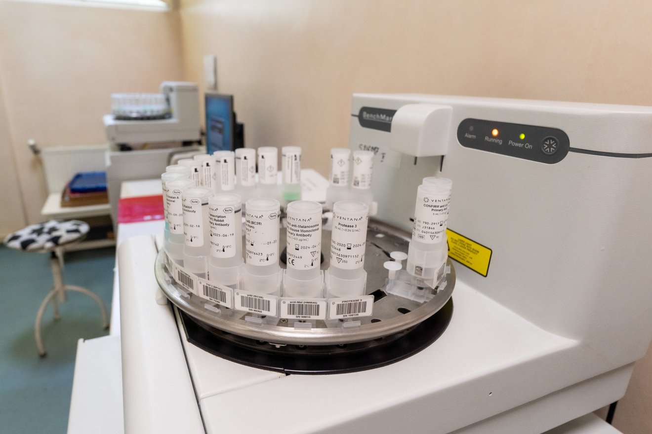 Genetikai vizsgálat a személyre szabott kezelésért: országosan egyedülálló fejlesztés Marosvásárhelyen