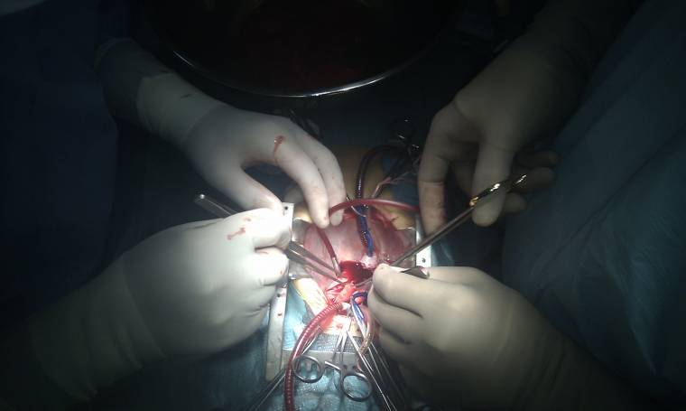 Csecsemő életét mentették meg